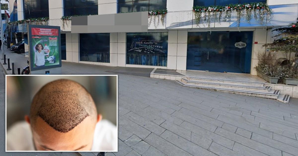 British tourist, 38, dies after Turkey hair transplant goes wrong | News World