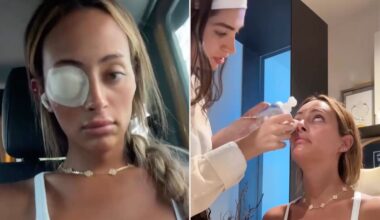 Emira D’Spain Used Donated Body Tissue to Relieve Her Dry Eyes