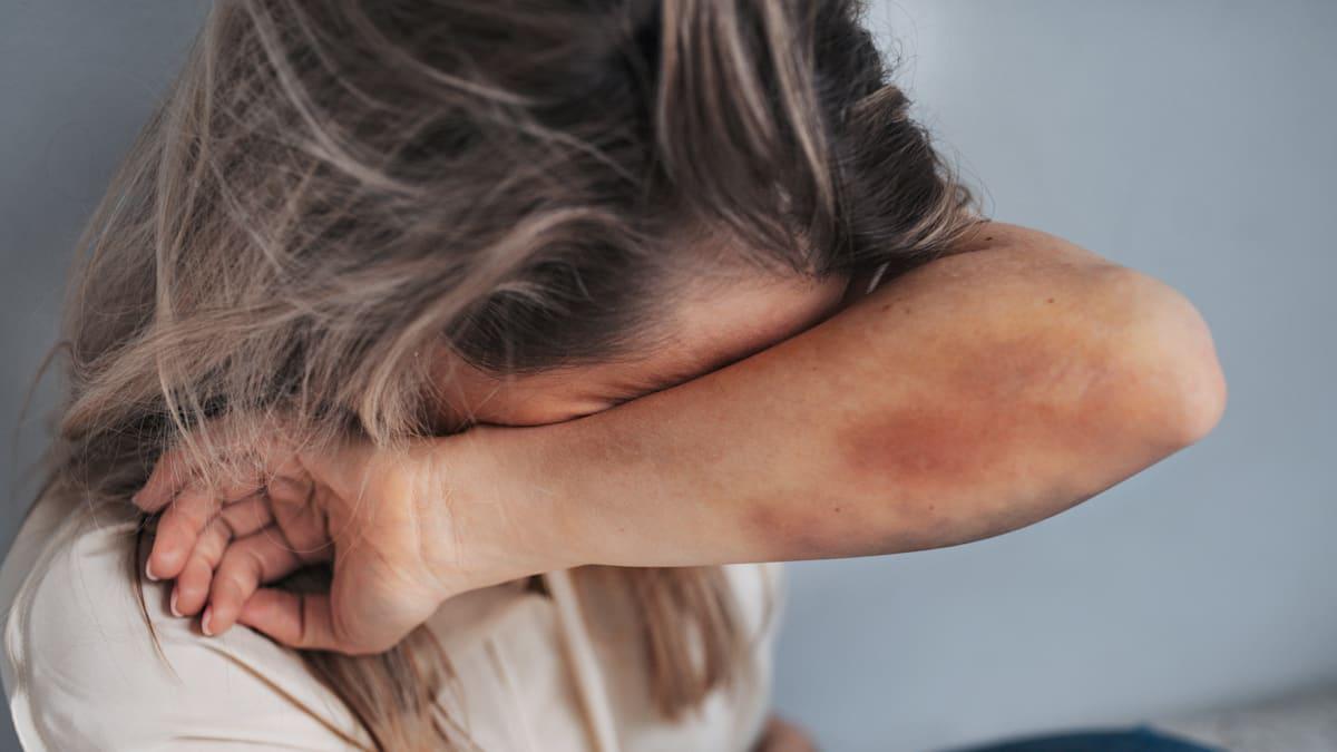 Häusliche Gewalt erreicht in Deutschland Allzeithoch