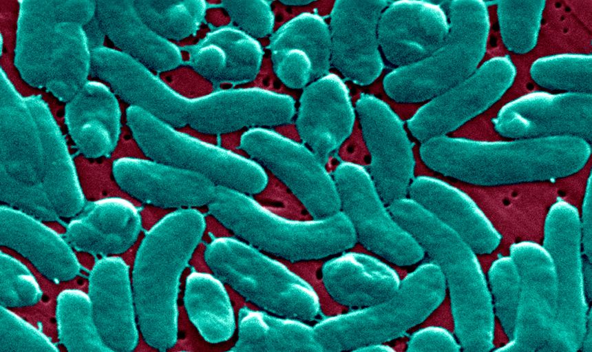An electron micrograph of Vibrio Vulnificus bacteria.