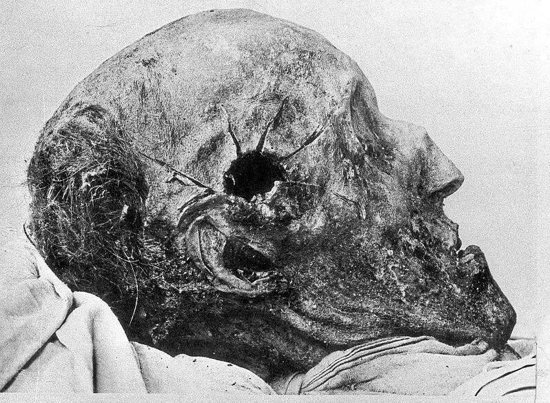 The head of the great commander and King of Sweden Charles XII with a hole from a fatal bullet received during the siege of the Fredriksten fortress in Norway.