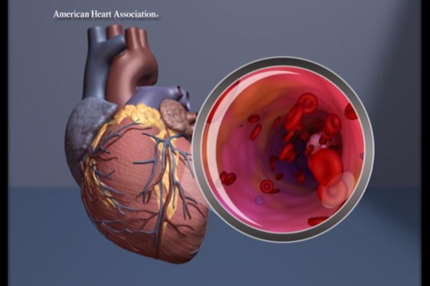 Study finds heart health declining in older adults with certain cardiovascular diseases