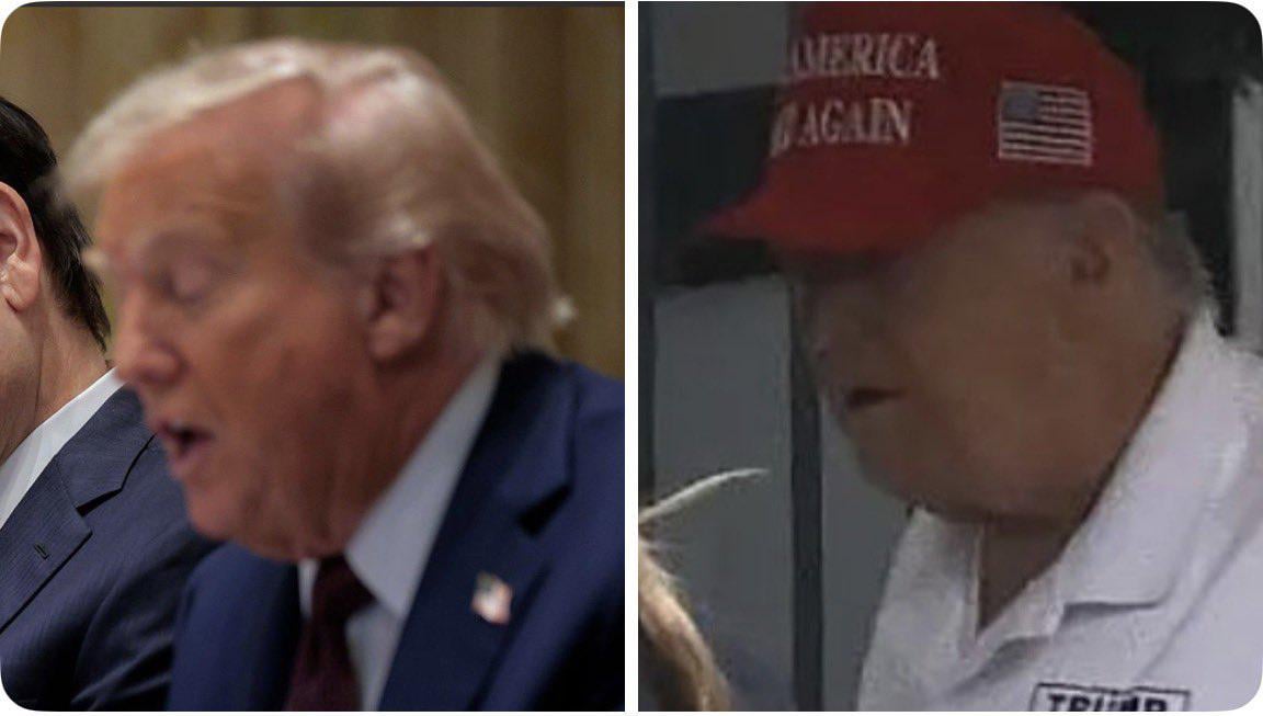 Look at these two pics of Trump — left is from 5 days ago, right is from Sunday. No doubt about it, these are not the same person!