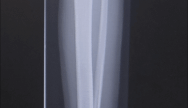 Zkusenost v nemocnici + co mam kurva ted delat?