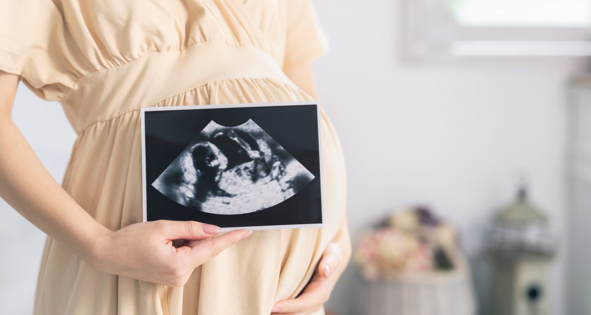 Pregnant woman in a dress holding ultrasound in front of her stomach