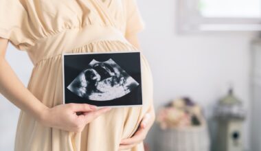 Pregnant woman in a dress holding ultrasound in front of her stomach