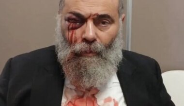 Jewish man assaulted in France over Shabbat