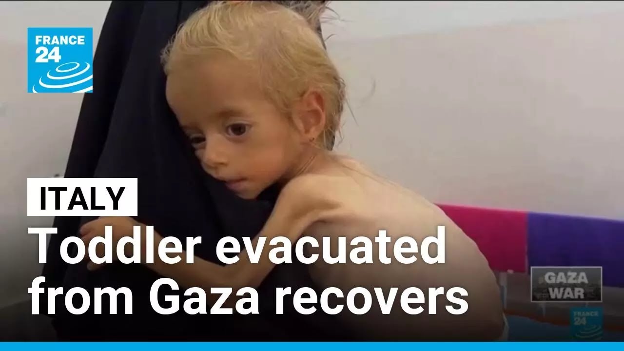 Toddler evacuated from Gaza recovers from malnutrition in Italian hospital • FRANCE 24 English