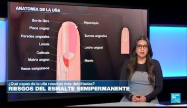 ¿Cuáles son los riesgos del uso de los esmaltes semipermanentes? • FRANCE 24 Español