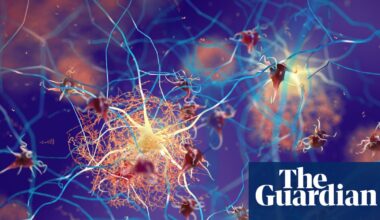 Is there hope on the horizon for patients with Alzheimer’s? – podcast | Science