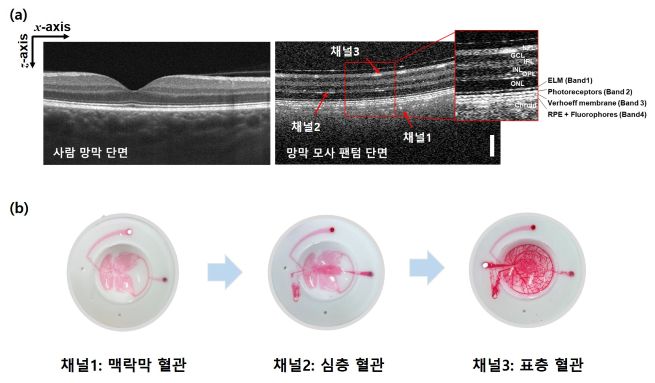 Structure of the artificial eye phantom developed by KRISS (Image provided by the Korea Research Institute of Standards and Science)
