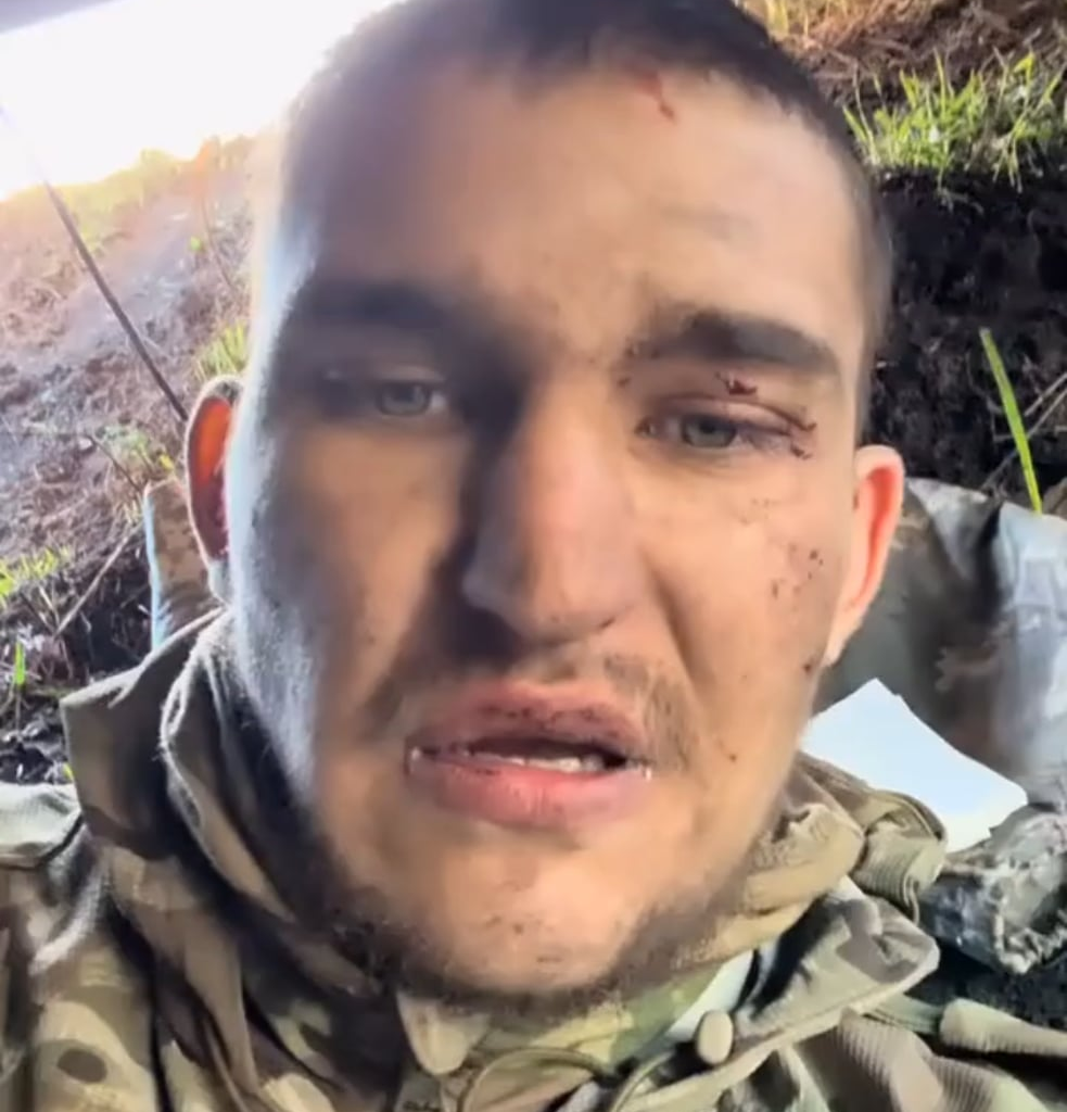"I’m 200, I’m 200." Final video from the phone of a russian invader whose legs were severely wounded by a Ukrainian drone
