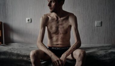 Years of torture, abuse in Russian captivity take shocking toll on Ukrainian POWs