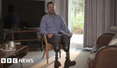 Surgeon Neil Hopper jailed after amputation of own legs