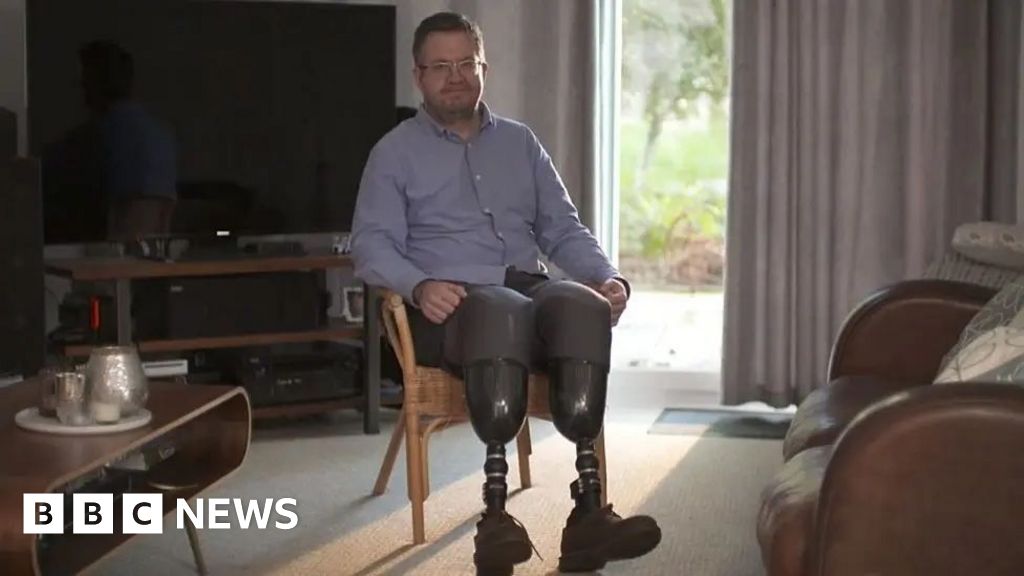 Surgeon Neil Hopper jailed after amputation of own legs