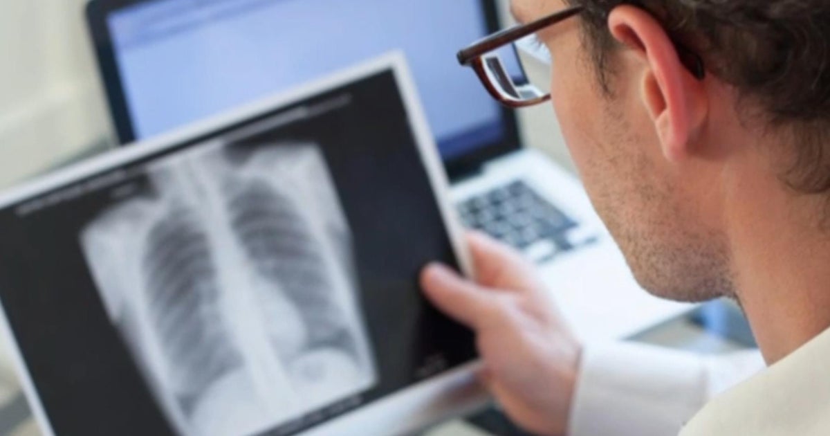 Health officials identify tuberculosis case at Riverside County high school