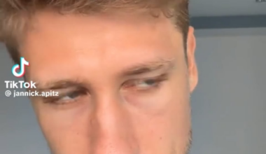 TIL there's a thing, German stare, why you do this?