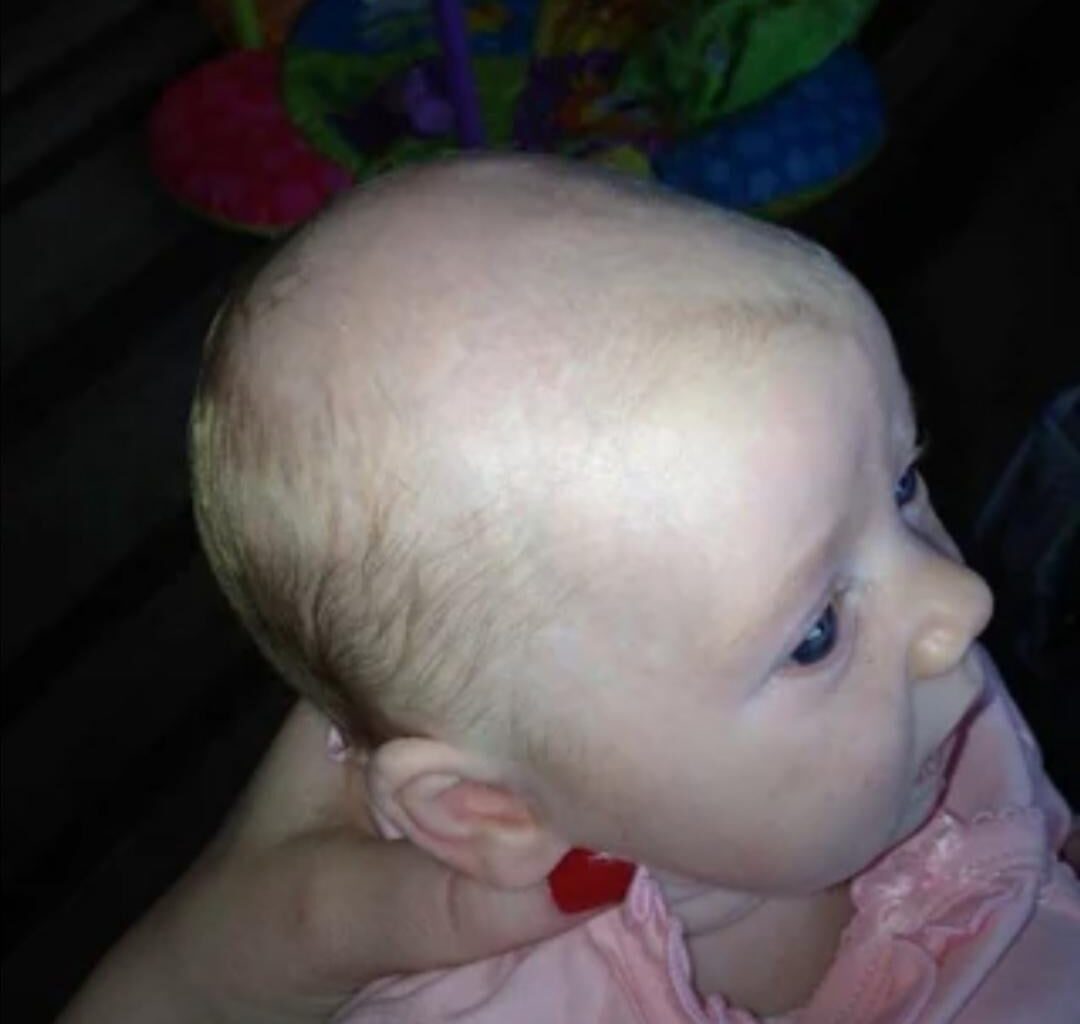 Yo les gars, je perds mes cheveux. C’est foutu?