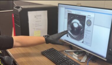 Brookhaven police use new technology to crack cases