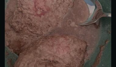 Mes steaks premachés de ce midi, désolé à ma mamie qui a manger ça (oui je premaches des steaks à ma mamie ,Elle n'a plus de dents)