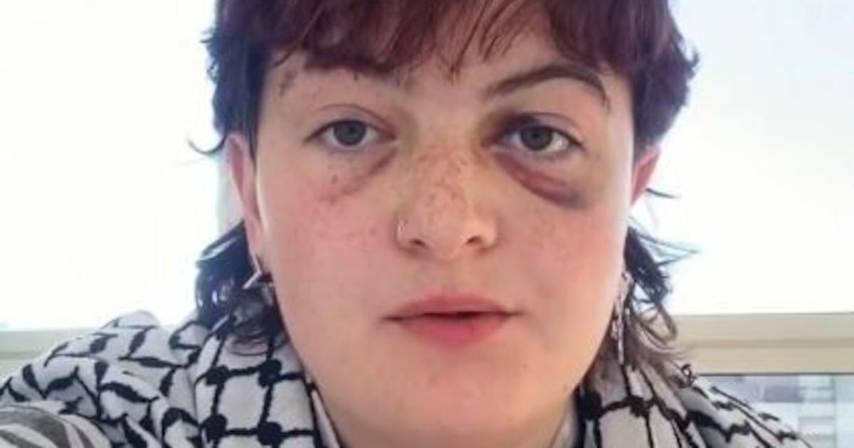 Irish protester Kitty O’Brien accuses Berlin police of widespread violence