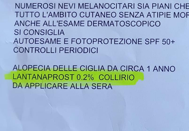 Sanità italiana: dottoressa mi prescrive l’acetone come collirio