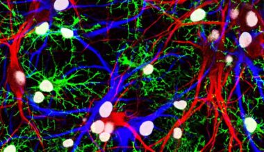 FTL1: This Protein Causes Aging In The Brain, And Scientists Have Learned How To Stop It