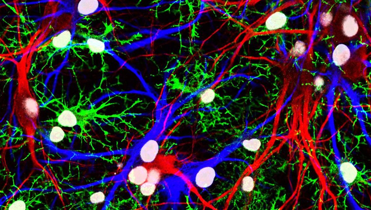 FTL1: This Protein Causes Aging In The Brain, And Scientists Have Learned How To Stop It