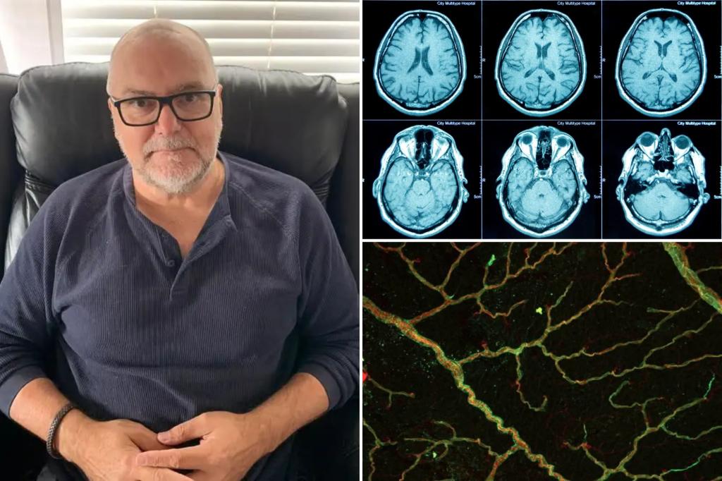 Australian man Patrick Dare's HR meeting reveals frontal lobe dementia diagnosis
