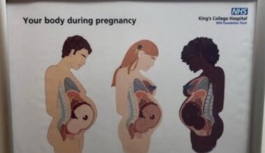 Barry, 63, is not fat, he's pregnant