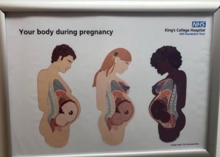 Barry, 63, is not fat, he's pregnant