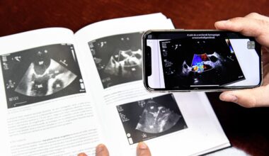 Artificial Intelligence Integrated into Smart Textbooks Across Hungary