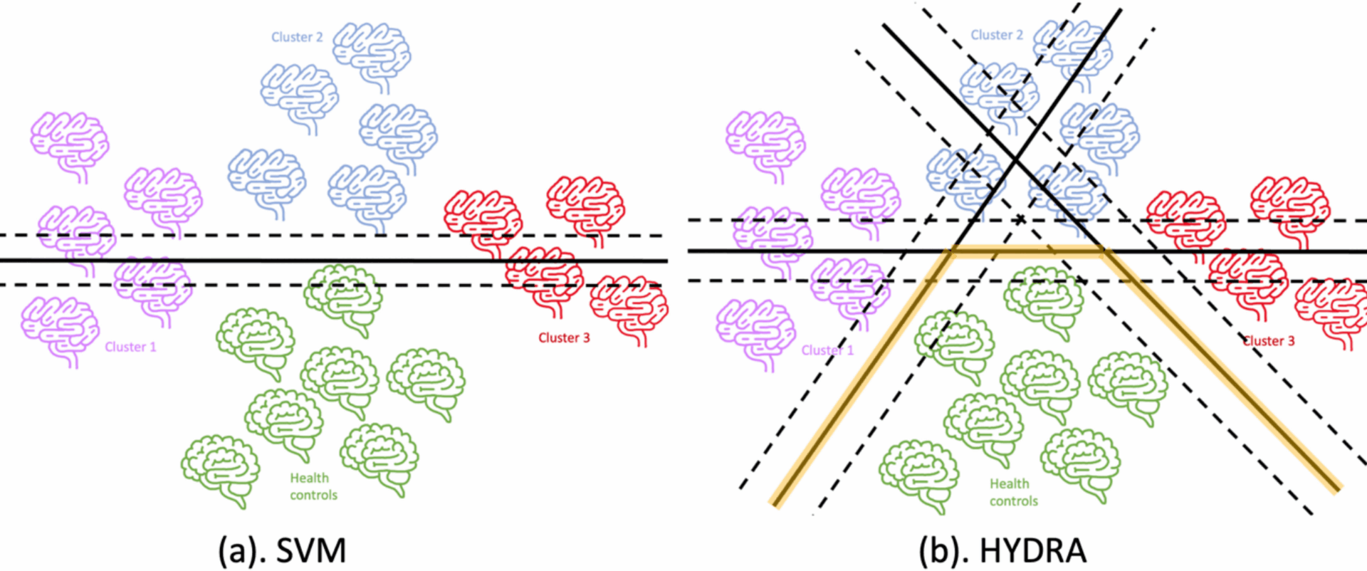 Dissecting real-world memory clinical cohort heterogeneity: analysis of neuroanatomical subtypes using HYDRA | Alzheimer's Research & Therapy