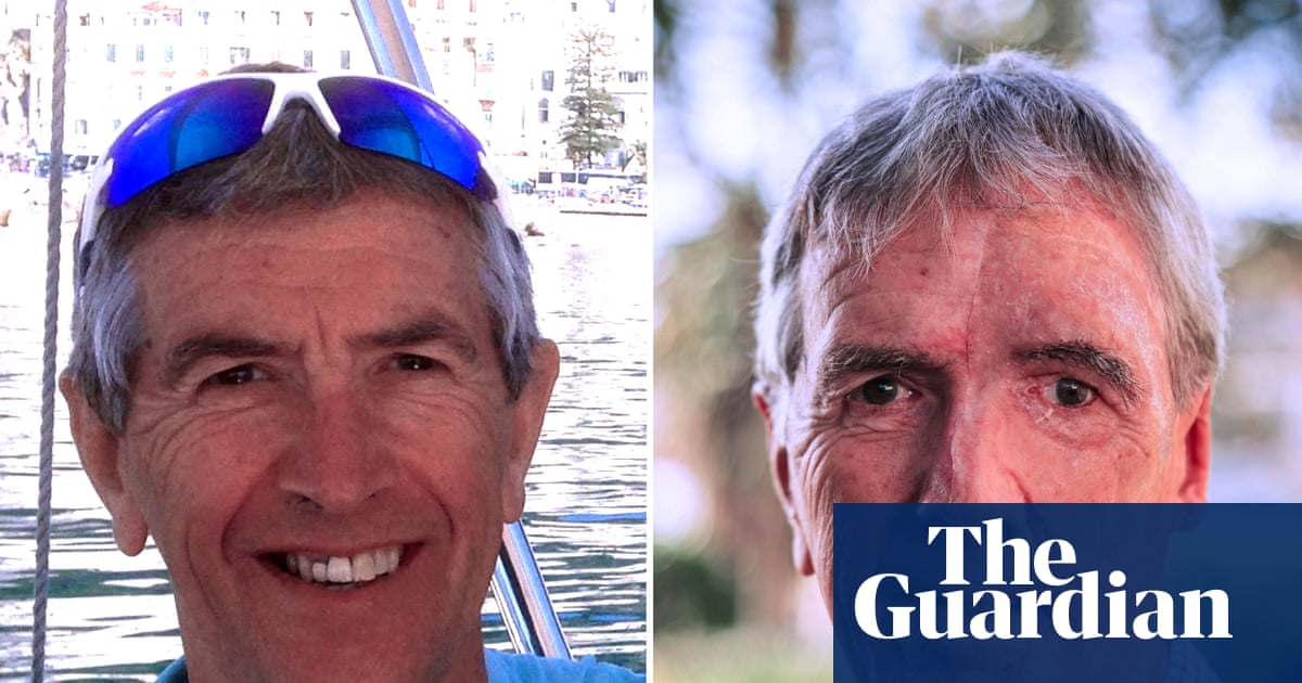 Cyclist gets 3D-printed face after drunk driver left him with third-degree burns | NHS