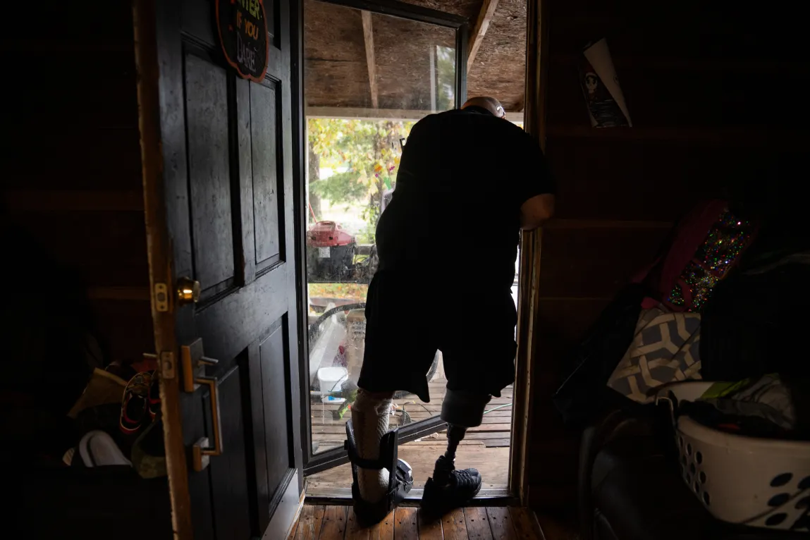 The silhouette of a man in a doorway. His left leg is in a brace, and he has a prosthetic right leg.