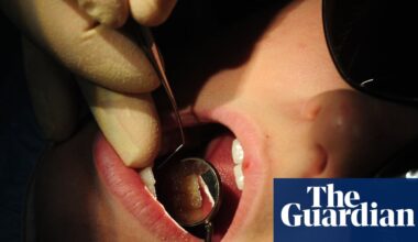 Toxin levels in fish lead to calls for UK-wide ban on mercury dental fillings | Environment