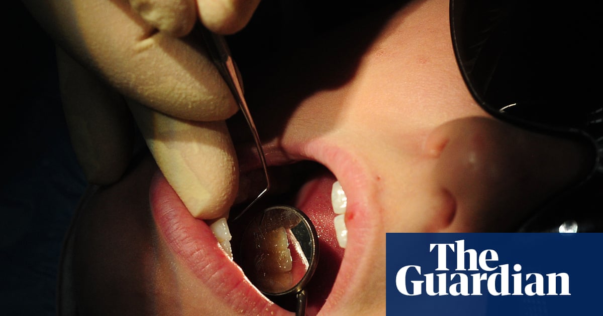 Toxin levels in fish lead to calls for UK-wide ban on mercury dental fillings | Environment