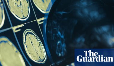 Smart jab can shrink head and neck cancer tumours within six weeks, trial finds | Cancer research