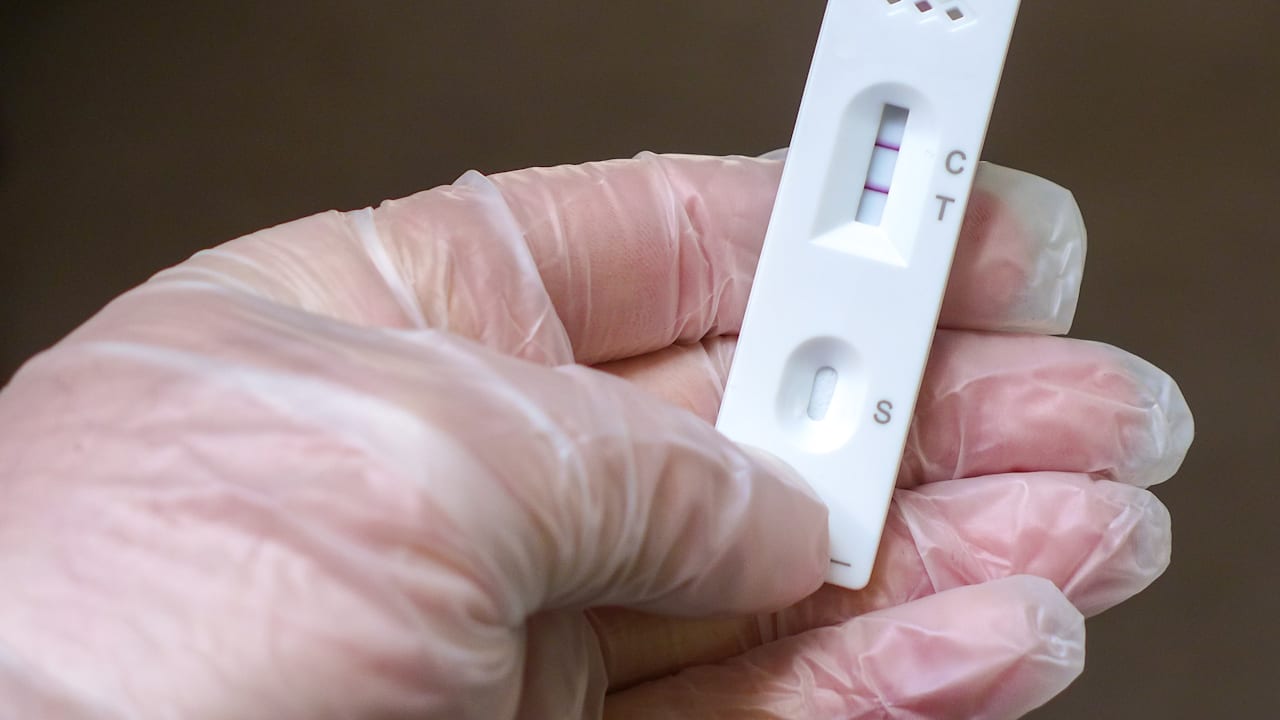 Neue Zahlen: Corona-Virus namens „Frankenstein“ breitet sich aus | News
