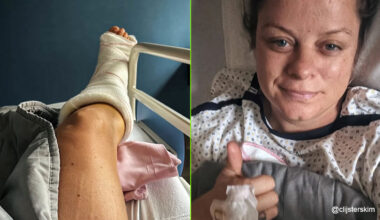 "Ik had nooit gedacht dat ik me nog zo ernstig zou blesseren na mijn carrière": Kim Clijsters geeft update na misstap op tennisterrein