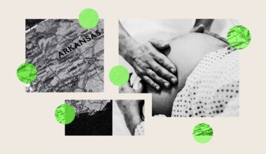 Hospital C-Section Rates Vary Widely. Women Often Can't See the Data.