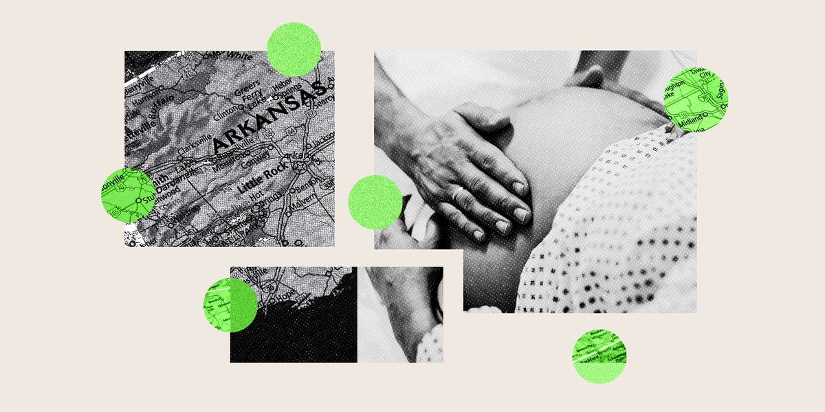 Hospital C-Section Rates Vary Widely. Women Often Can't See the Data.