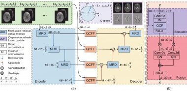 Q-space-coordinate-guided neural networks for high-fidelity diffusion tensor estimation from minimal diffusion-weighted images