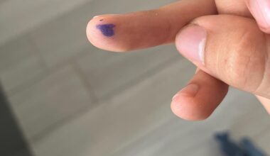 Tengo una mancha de boli en el dedo con forma de España.
