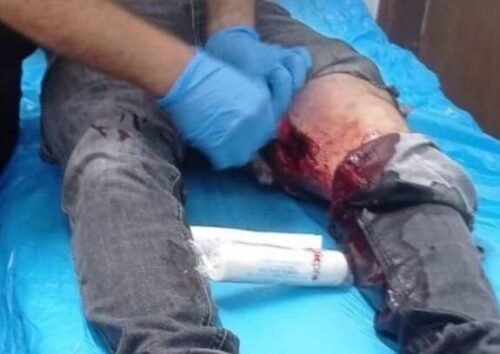 Israeli Forces Shoot Three Palestinians Near Jerusalem |