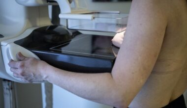 Cancerfondens kampanj om mammografi stoppas på Facebook