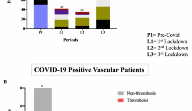 Impact of the COVID-19 Pandemic on Vascular Surgery Services in a United Kingdom Tertiary Center