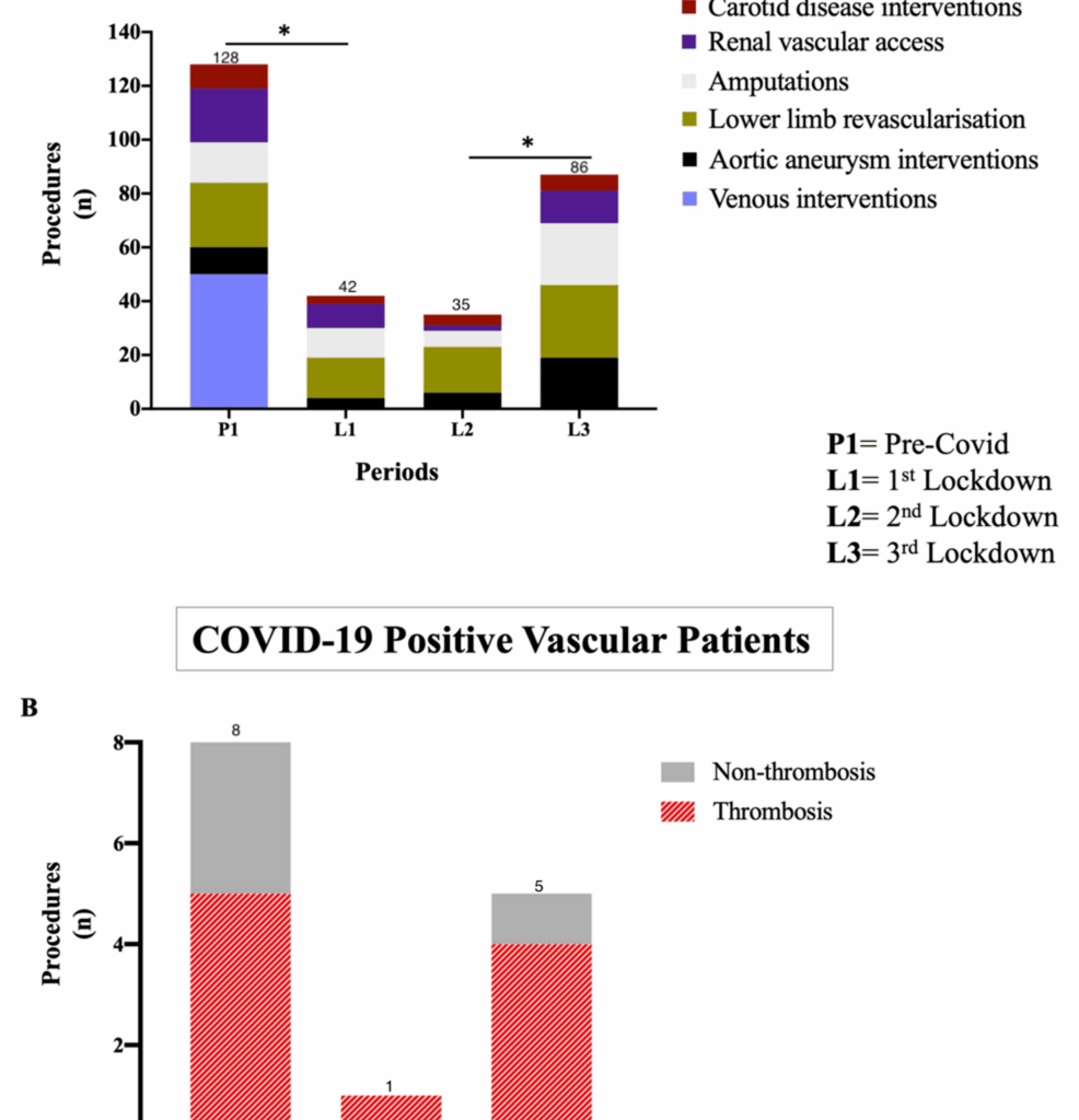 Impact of the COVID-19 Pandemic on Vascular Surgery Services in a United Kingdom Tertiary Center