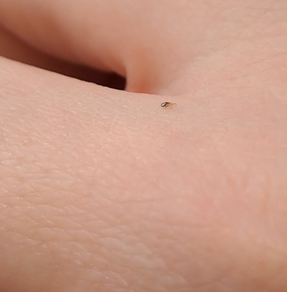 Zecke oder was ist das?