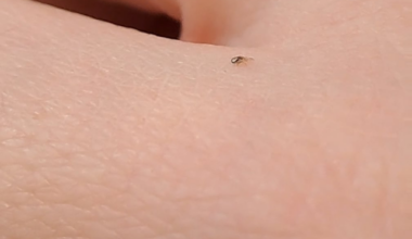 Zecke oder was ist das?